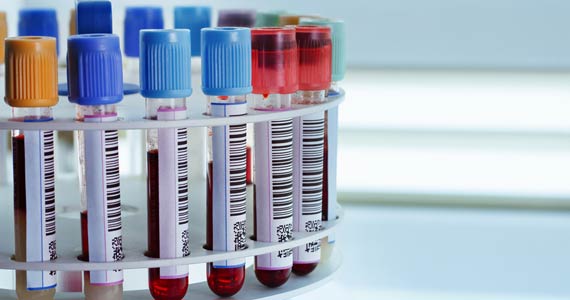 Testing | U.S. Anti-Doping Agency (USADA)