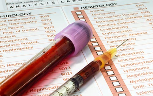 Drug Free Sport Perspectives Blood Testing For Prohibited Substances