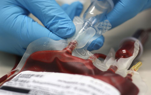 A close up of gloves hands putting an IV into a bag of blood.