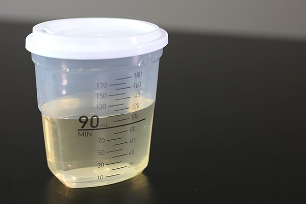 Urine collection cup full slightly over 90 milliliters.